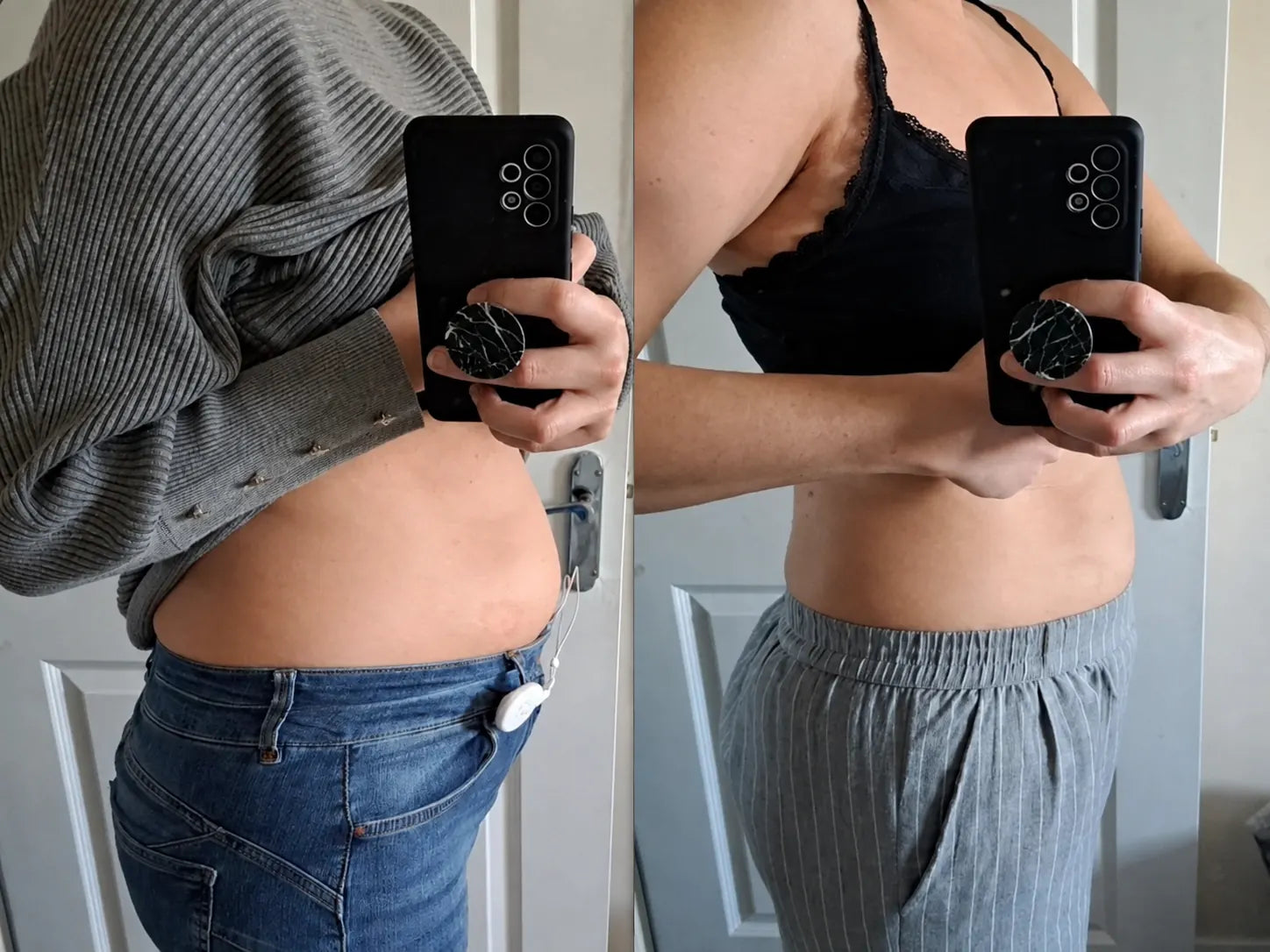 Hannah D., 31 before and after