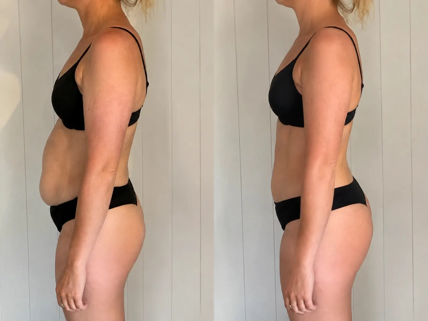 Erin K., 36 before and after