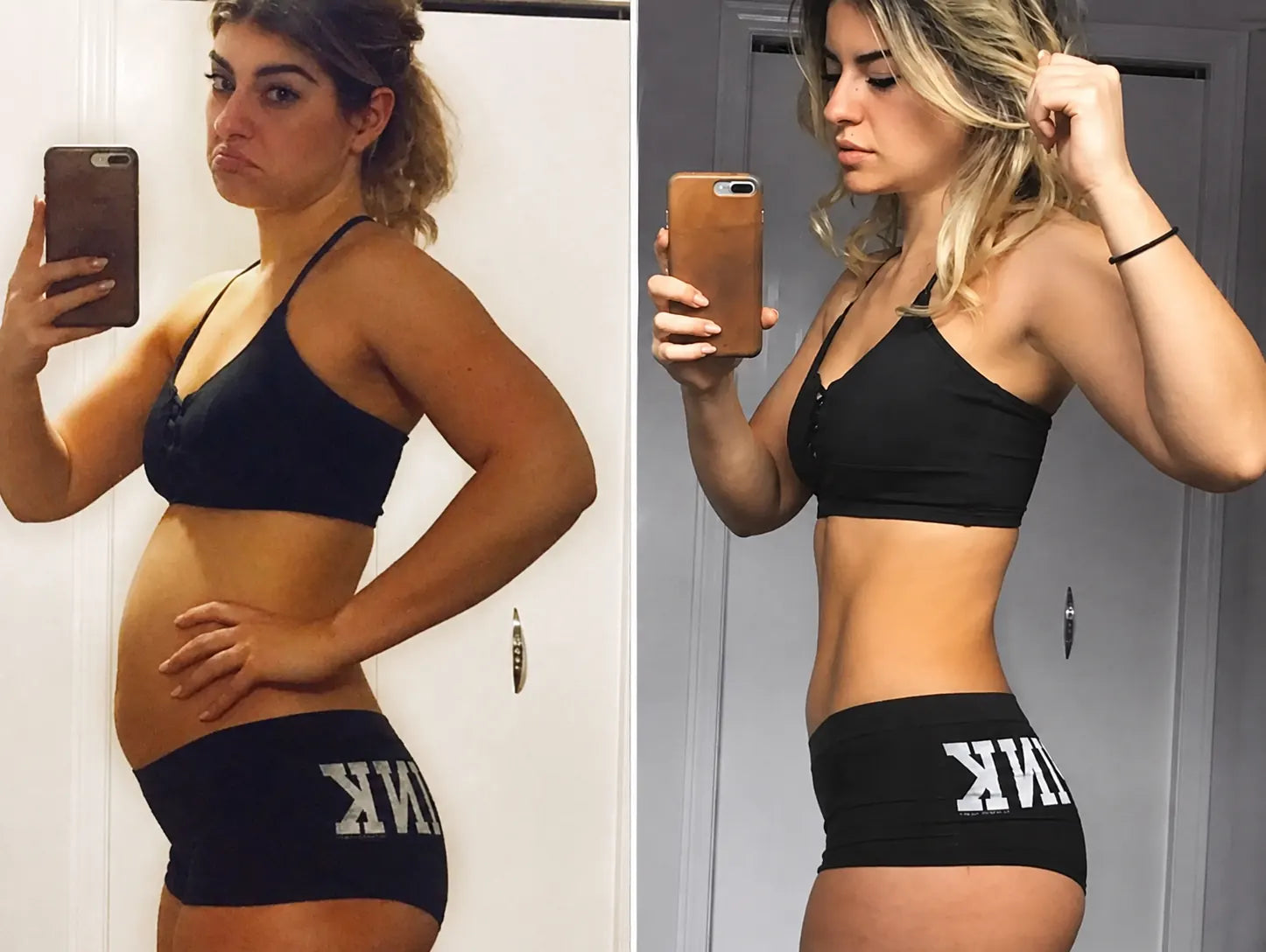 Mei L., 26 before and after