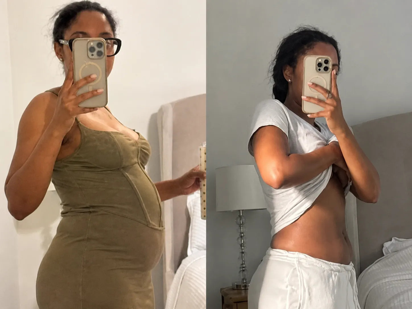 Simone R., 30 before and after